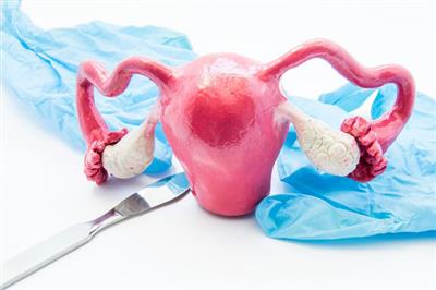 Cắt buồng trứng điều trị ung thư buồng trứng hết bao nhiêu tiền?